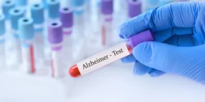Alzheimer's diagnosis tests